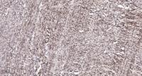 Dlx-4 Polyclonal Antibody