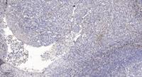 DMBT1 Polyclonal Antibody