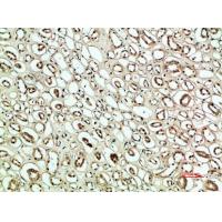 PLK2 Polyclonal Antibody