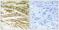 Dmc1 Polyclonal Antibody