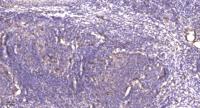 PLK-5 Polyclonal Antibody