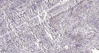 DMGDH Polyclonal Antibody