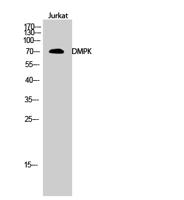 DMPK Polyclonal Antibody
