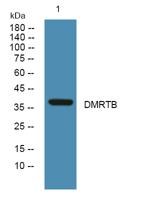DMRTB Polyclonal Antibody