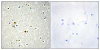DNA Ligase I Polyclonal Antibody