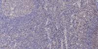 DNA Ligase IV Polyclonal Antibody