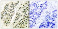 DNA pol β Polyclonal Antibody