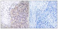 DNA pol γ2 Polyclonal Antibody