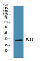 PLS2 Polyclonal Antibody