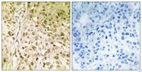 DNA pol θ Polyclonal Antibody