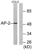 AP-2α/β Polyclonal Antibody