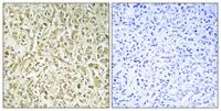 DNA pol λ Polyclonal Antibody
