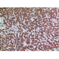Apaf-1 Polyclonal Antibody