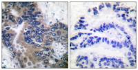 Apaf-1-ALT Polyclonal Antibody