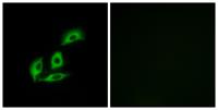 APBA2BP Polyclonal Antibody