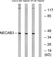 APBA2BP Polyclonal Antibody