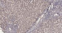 APBA2BP Polyclonal Antibody