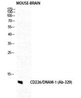 DNAM-1 Polyclonal Antibody