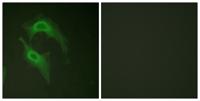 DNAM-1 Polyclonal Antibody
