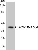 DNAM-1 Polyclonal Antibody