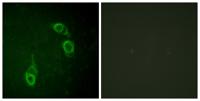 APC1 Polyclonal Antibody