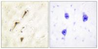 APC1 Polyclonal Antibody