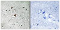 APC1 Polyclonal Antibody