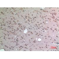 Apelin Polyclonal Antibody