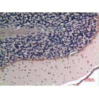 Apelin Polyclonal Antibody