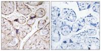 APHC Polyclonal Antibody