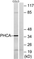 APHC Polyclonal Antibody
