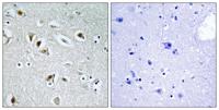 DOC-1R Polyclonal Antibody