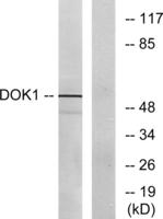 Dok-1 Polyclonal Antibody