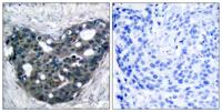 Dok-2 Polyclonal Antibody