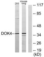 Dok-4 Polyclonal Antibody