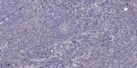 Dok-4 Polyclonal Antibody