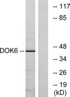 Dok-6 Polyclonal Antibody