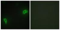Dok-7 Polyclonal Antibody