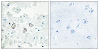 Dok-7 Polyclonal Antibody