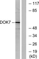 Dok-7 Polyclonal Antibody
