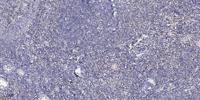 GCN2 Polyclonal Antibody