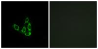 GCNT3 Polyclonal Antibody