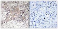 GCNT3 Polyclonal Antibody
