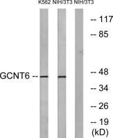 GCNT6 Polyclonal Antibody