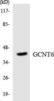GCNT6 Polyclonal Antibody