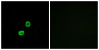 GCNT7 Polyclonal Antibody