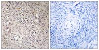 GCNT7 Polyclonal Antibody