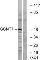GCNT7 Polyclonal Antibody
