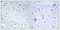 GCP3 Polyclonal Antibody