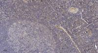 GCP4 Polyclonal Antibody
